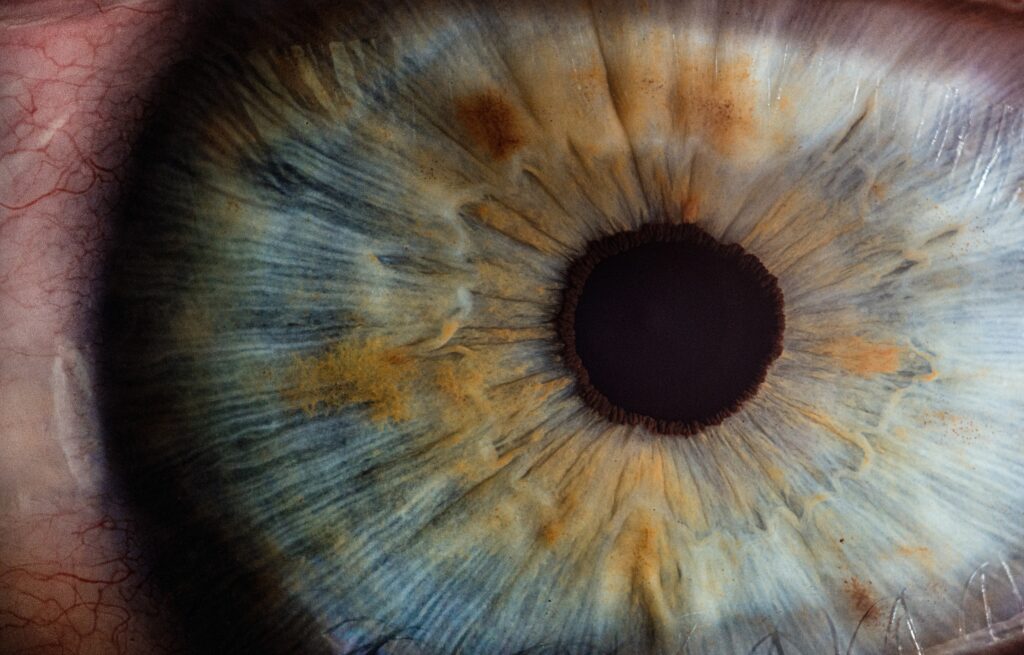 Acercamiento del ojo humano. La pupila se encuentra dilatada.